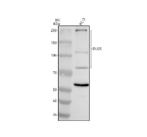 Anti-DLG5 Antibody Picoband® Boster Bio