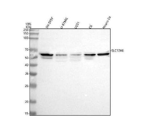 Anti-VGLUT2/SLC17A6 Antibody Picoband® Boster Bio