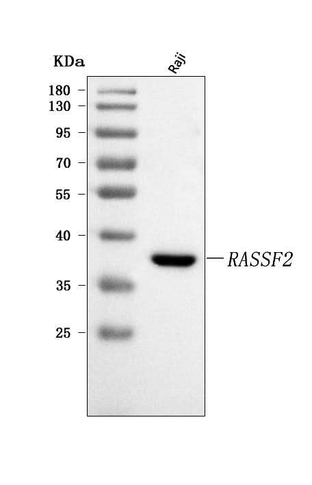 Anti-RASSF2 Antibody Picoband® Boster Bio