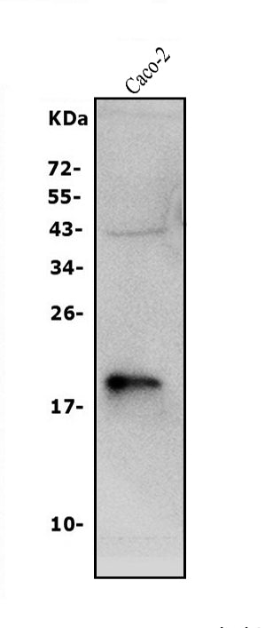Anti-Claudin 3/CLDN3 Antibody Picoband® Boster Bio