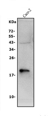 Anti-Claudin 3/CLDN3 Antibody Picoband® Boster Bio