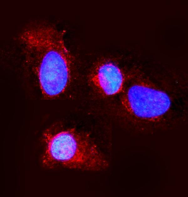 Anti-Claudin 3/CLDN3 Antibody Picoband® Boster Bio