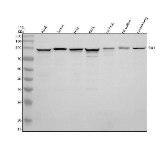 Anti-Snf1lk/SIK1 Antibody Picoband® Boster Bio