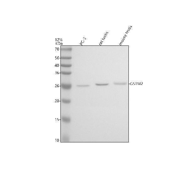 Anti-GSTM2 Antibody Picoband® Boster Bio
