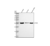 Anti-GSTM2 Antibody Picoband® Boster Bio
