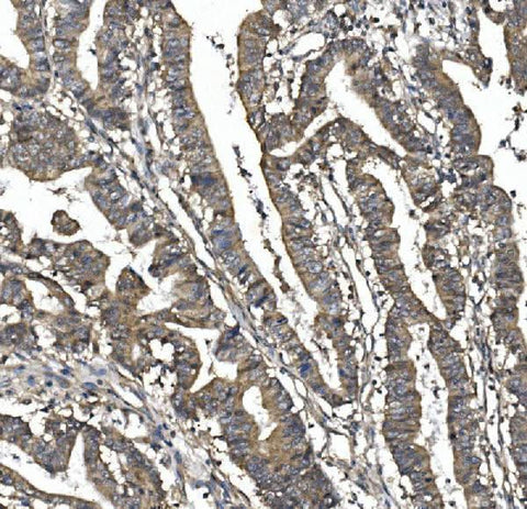 Anti-SORBS1 Picoband® Antibody Boster Bio