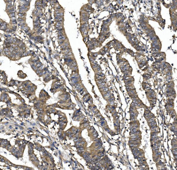 Anti-SORBS1 Picoband® Antibody Boster Bio