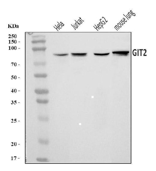 Anti-GIT2 Antibody Picoband® Boster Bio
