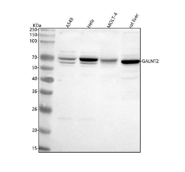 Anti-GALNT2 Antibody Picoband® Boster Bio