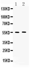 Anti-MMP11 Antibody Picoband® Boster Bio