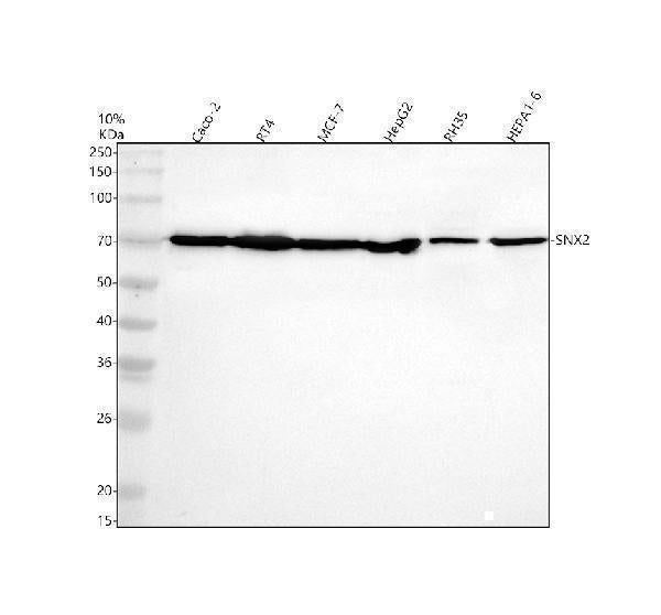 Anti-SNX2 Antibody Picoband® Boster Bio