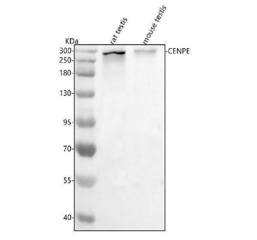 Anti-Cenpe Antibody Picoband® Boster Bio