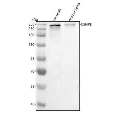 Anti-Cenpe Antibody Picoband® Boster Bio