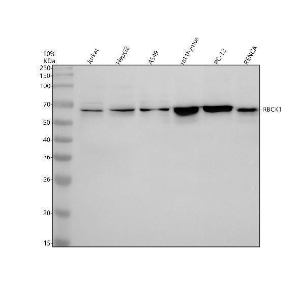 Anti-RBCK1 Antibody Picoband® Boster Bio