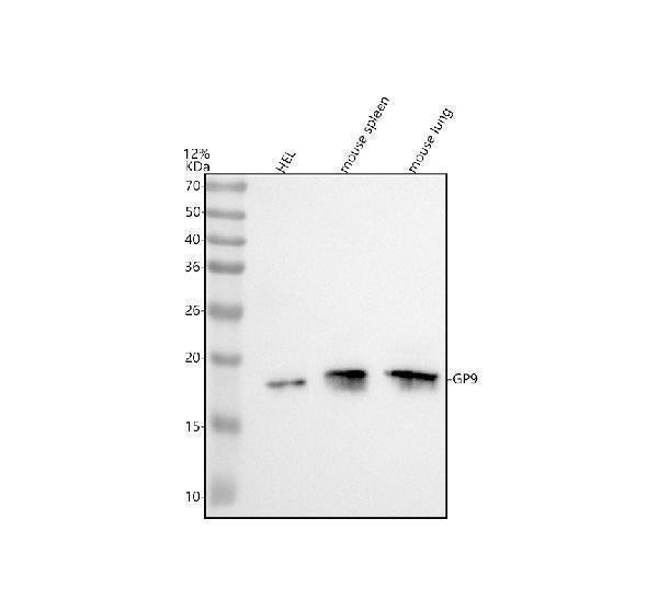 Anti-CD42a/GP9 Antibody Picoband® Boster Bio
