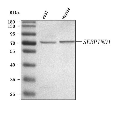 Anti-SERPIND1 Antibody Picoband® Boster Bio