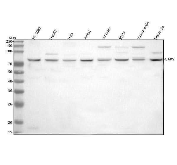 Anti-GARS1 Antibody Picoband® Boster Bio