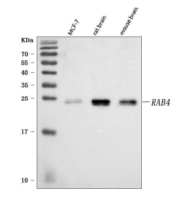 Anti-Rab4/RAB4A Antibody Picoband® Boster Bio