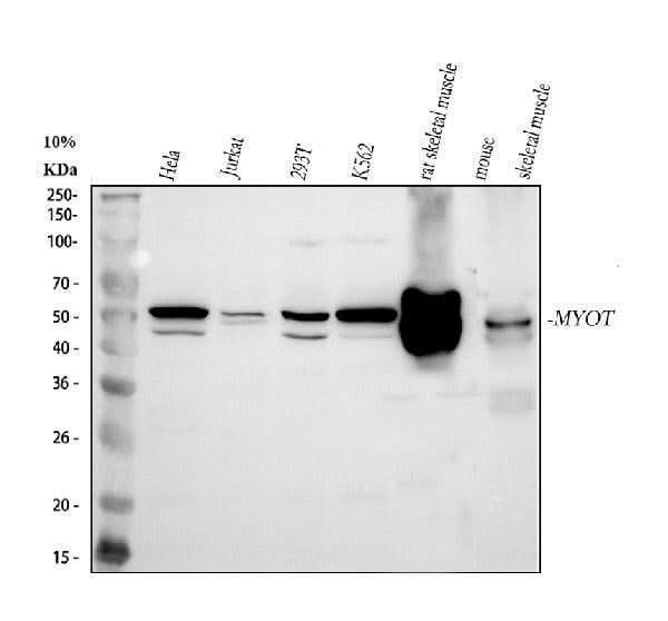 Anti-MYOT Antibody Picoband® Boster Bio