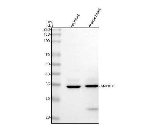Anti-ANKRD1 Antibody Picoband® Boster Bio