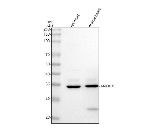 Anti-ANKRD1 Antibody Picoband® Boster Bio
