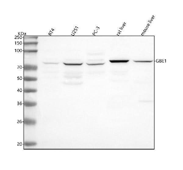 Anti-GBE1 Antibody Picoband® Boster Bio