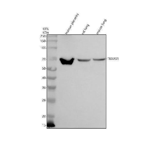 Anti-TBXAS1 Antibody Picoband® Boster Bio