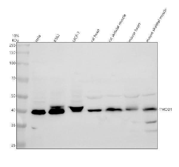 Anti-TMOD1 Antibody Picoband® Boster Bio
