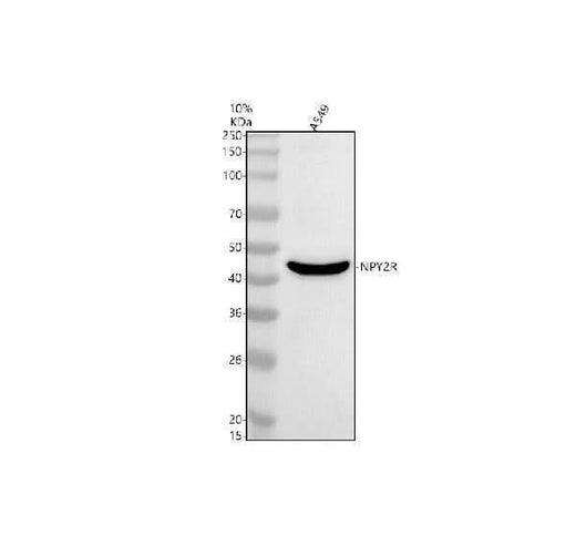 Anti-NPY2R Antibody Picoband® Boster Bio