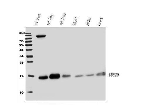 Anti-UBE2D1/2/3/4 Antibody Picoband® Boster Bio