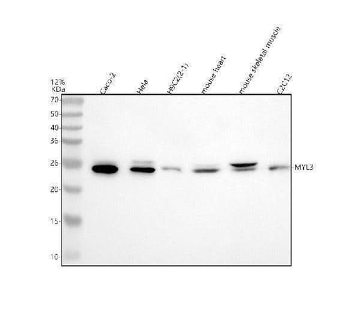 Anti-MYL3 Antibody Picoband® Boster Bio