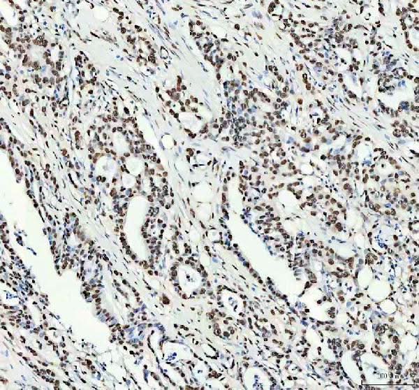 Anti-NKX2-2 Antibody Boster Bio