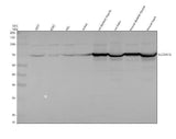 Anti-SLC25A12 Antibody Picoband® Boster Bio