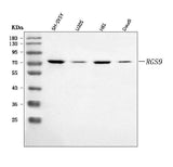 Anti-RGS9 Antibody Picoband® Boster Bio