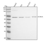 Anti-ACVR2A Antibody Picoband® Boster Bio