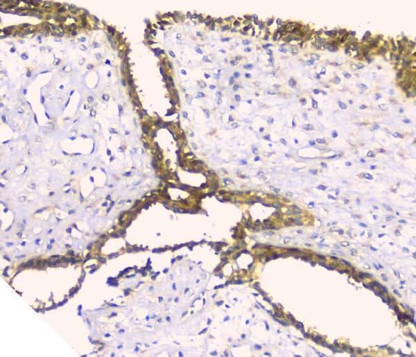 Anti-Hyaluronan synthase 1/HAS1 Antibody Picoband® Boster Bio