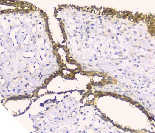 Anti-Hyaluronan synthase 1/HAS1 Antibody Picoband® Boster Bio