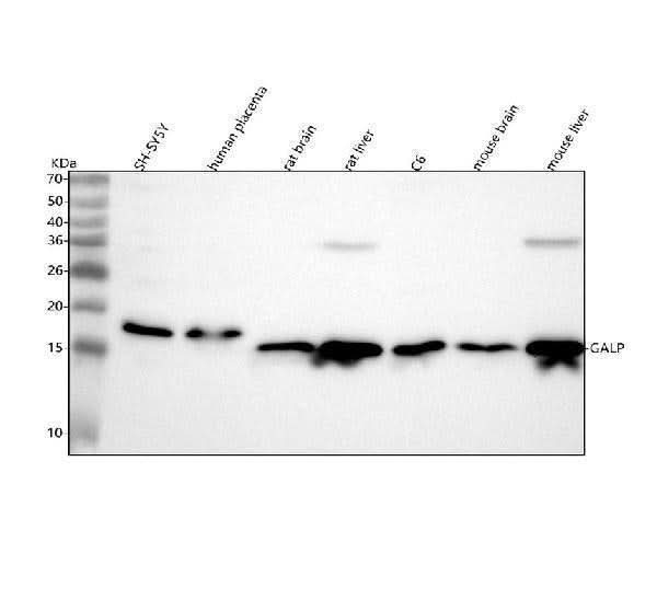 Anti-GALP Antibody Picoband® Boster Bio