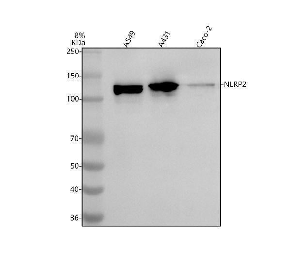 Anti-NLRP2 Antibody Picoband® Boster Bio