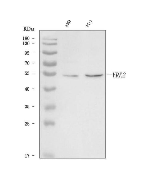 Anti-VRK2 Antibody Picoband® Boster Bio