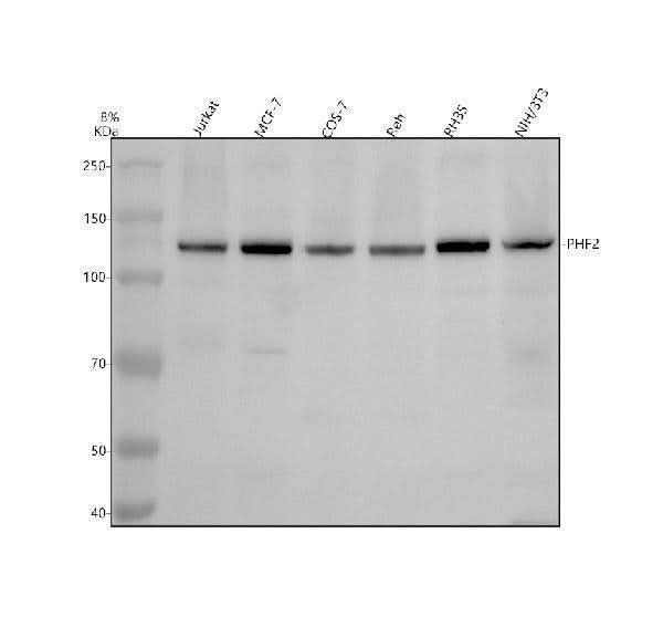 Anti-PHF2 Antibody Picoband® Boster Bio
