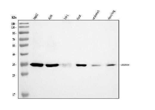 Anti-Annexin-4/ANXA4 Antibody Picoband® Boster Bio