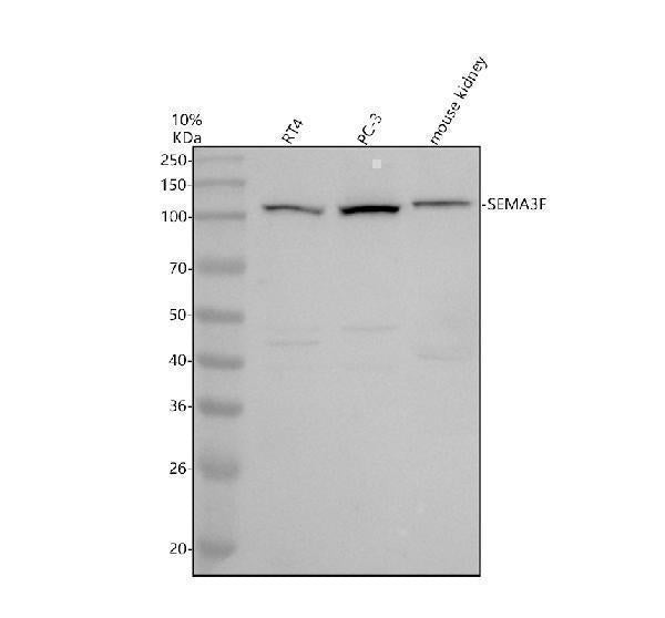 Anti-SEMA3F Antibody Picoband® Boster Bio