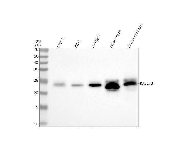 Anti-RAB27B Antibody Picoband® Boster Bio