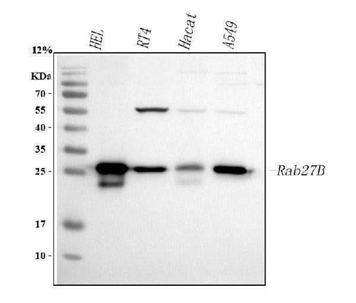 Anti-RAB27B Antibody Picoband® Boster Bio