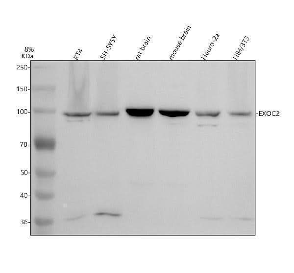 Anti-DNAJB9 Antibody Picoband® Boster Bio