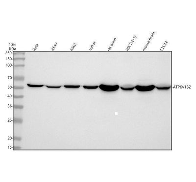 Anti-ATP6V1B2 Antibody Picoband® Boster Bio