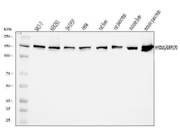 Anti-ORP150/HYOU1 Antibody Picoband® Boster Bio