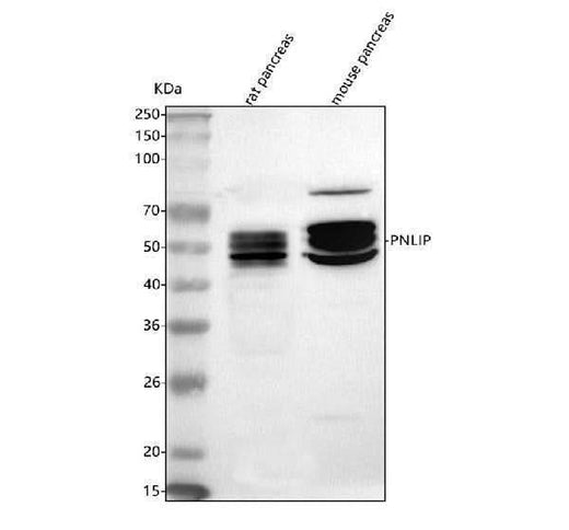 Anti-Pancreatic Lipase/PNLIP Antibody Picoband® Boster Bio