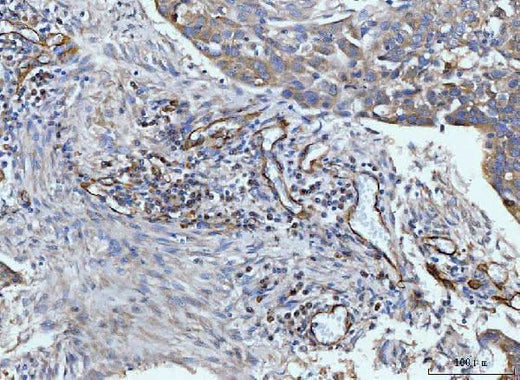 Anti-CD93 Antibody Boster Bio